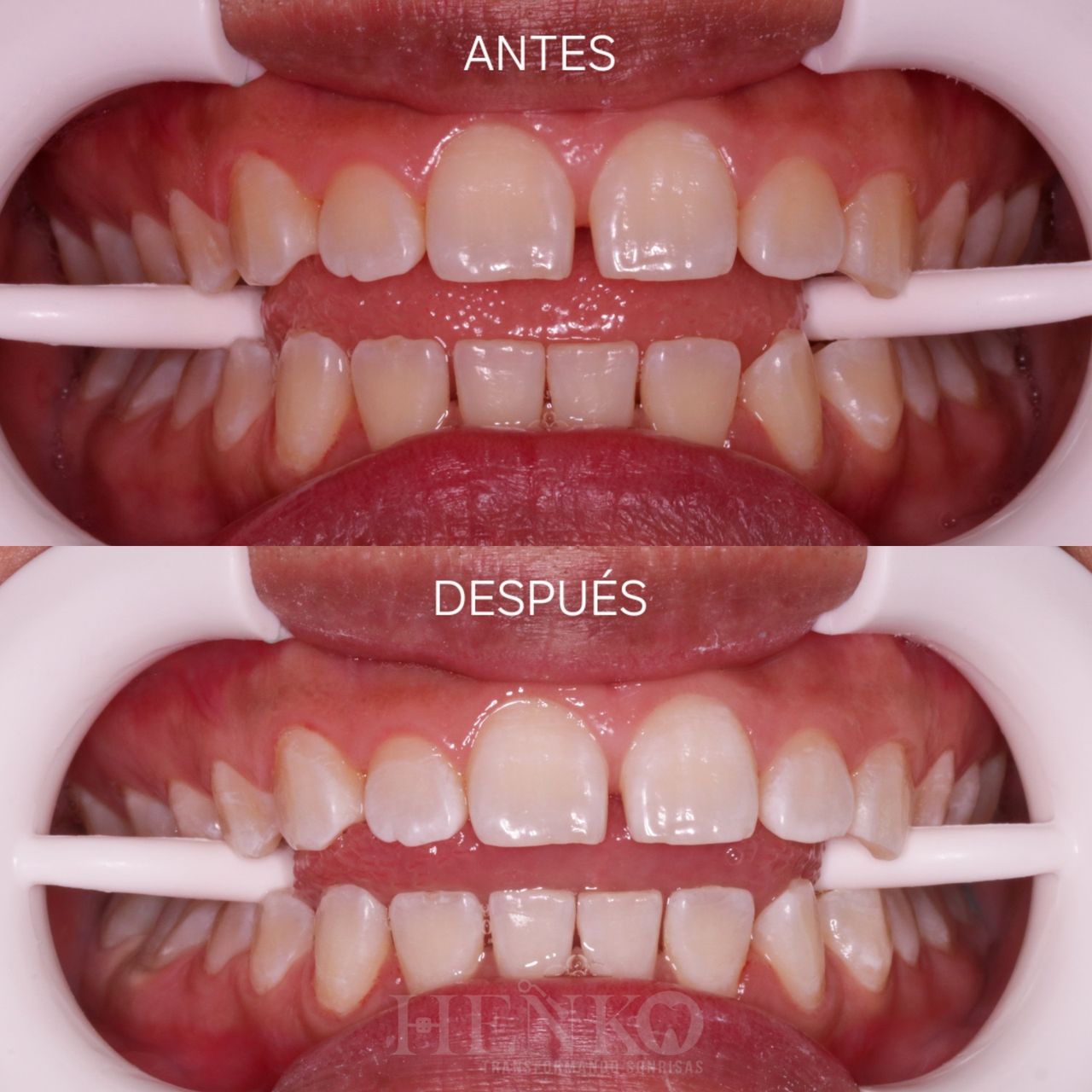 Zurisadai Salinas Chávez-15