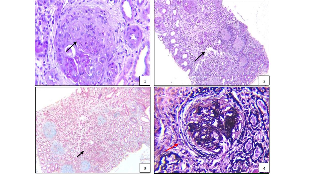 Cindy Paola Salazar Gana-17