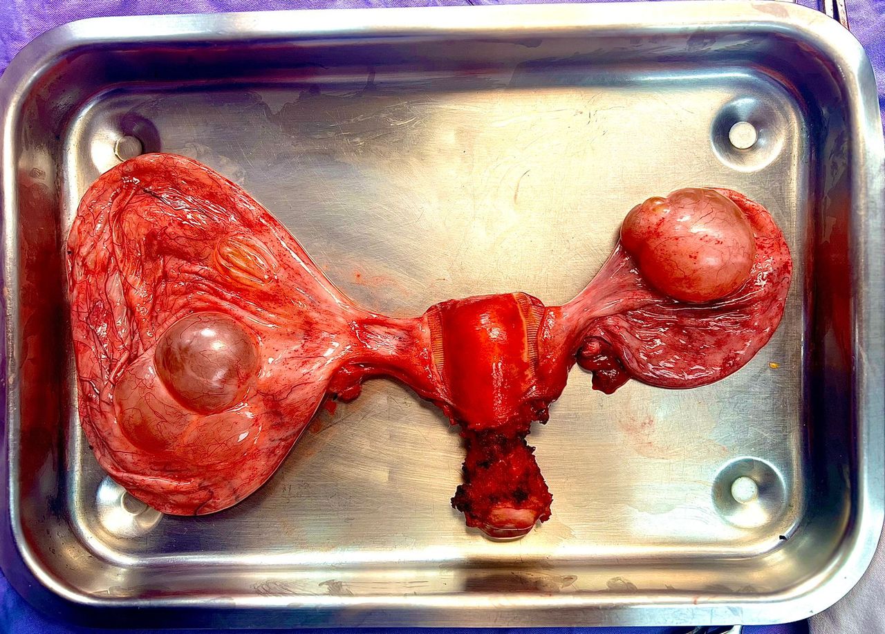 Alejandra Alizbeth Gonzalez Carrillo-0