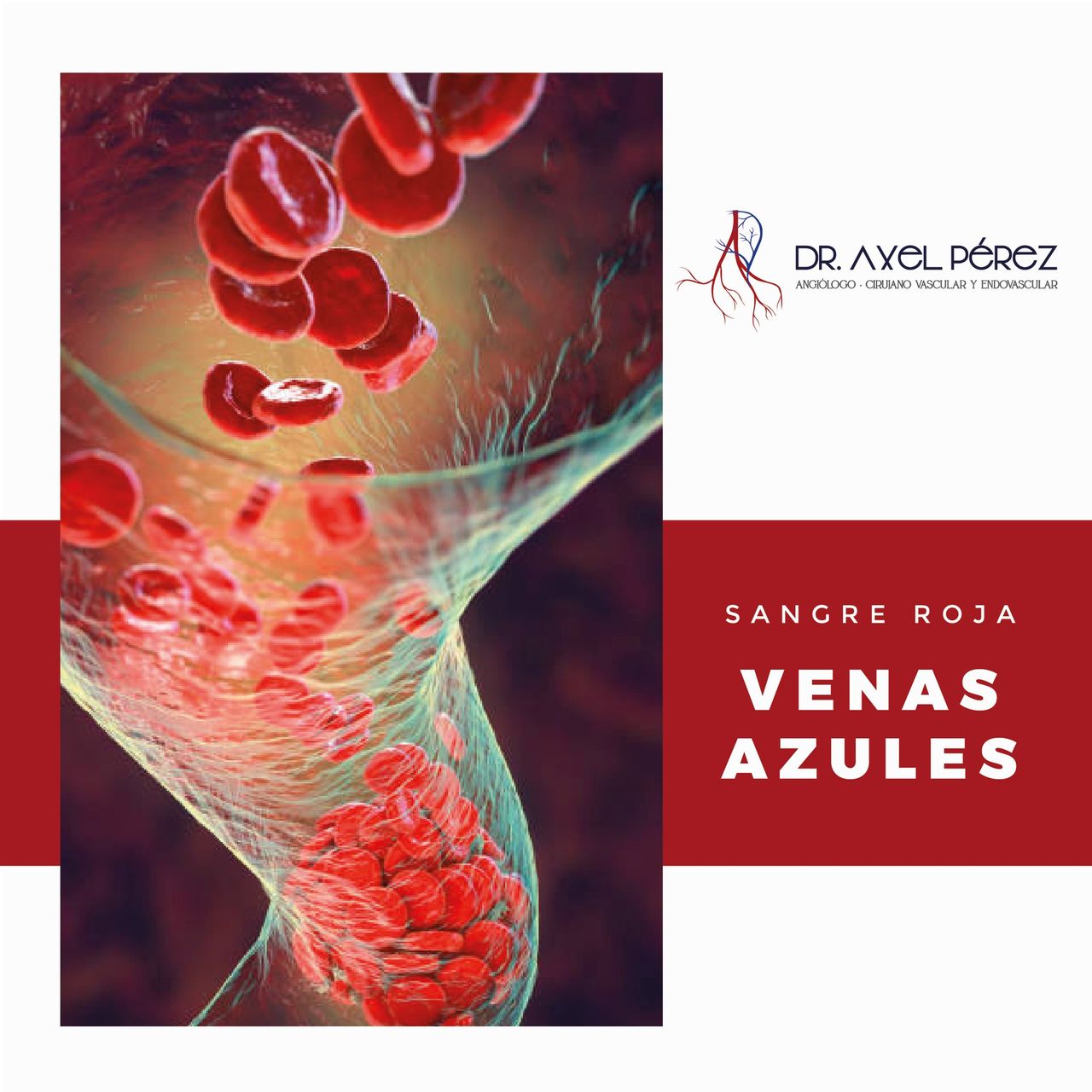 Axel Iván Pérez Flores-11