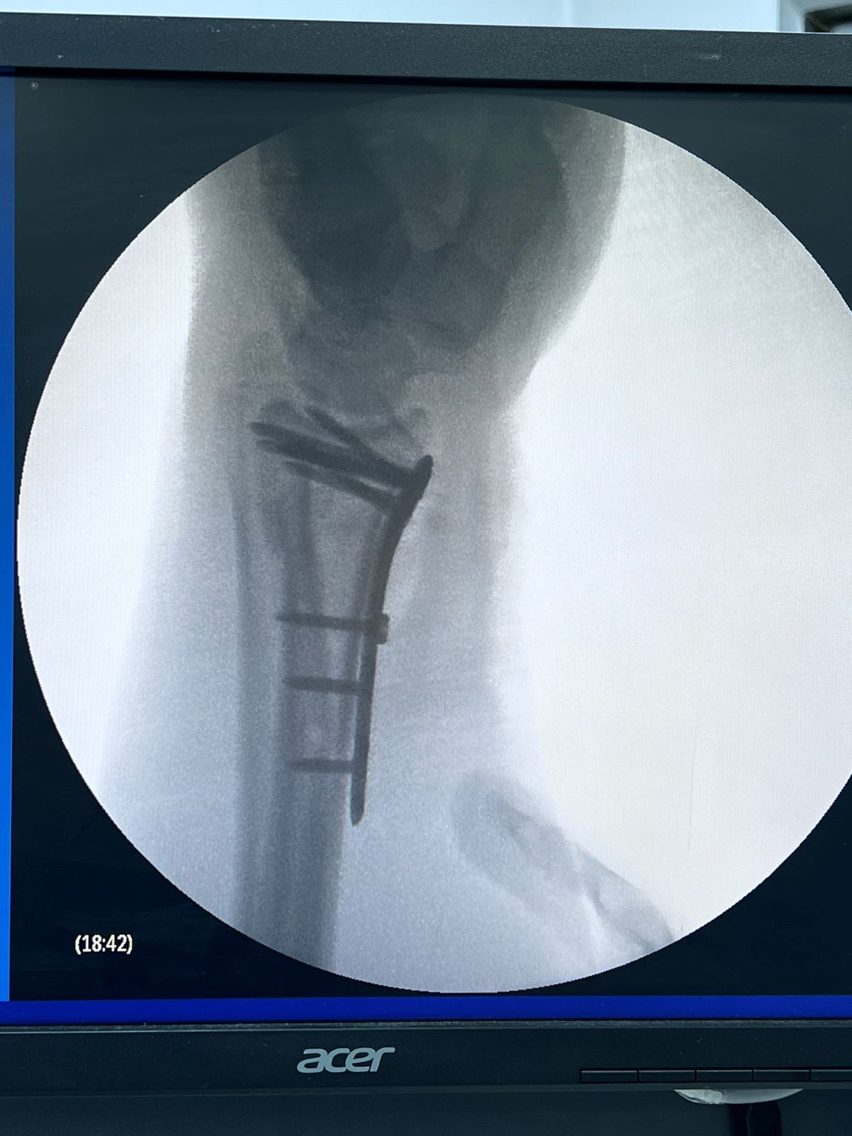 Karen Prieto Reyes-4