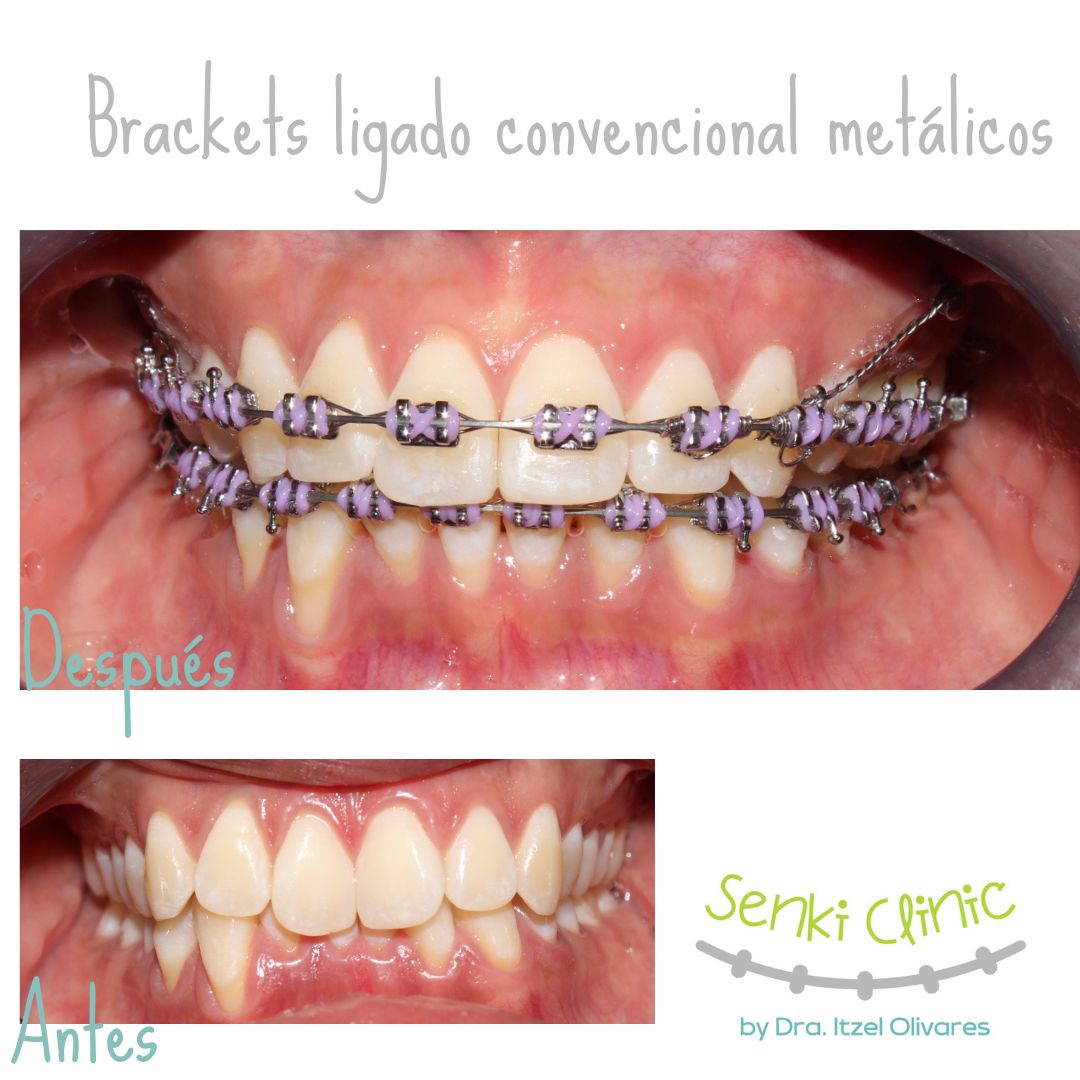 Itzel Olivares Lara-15