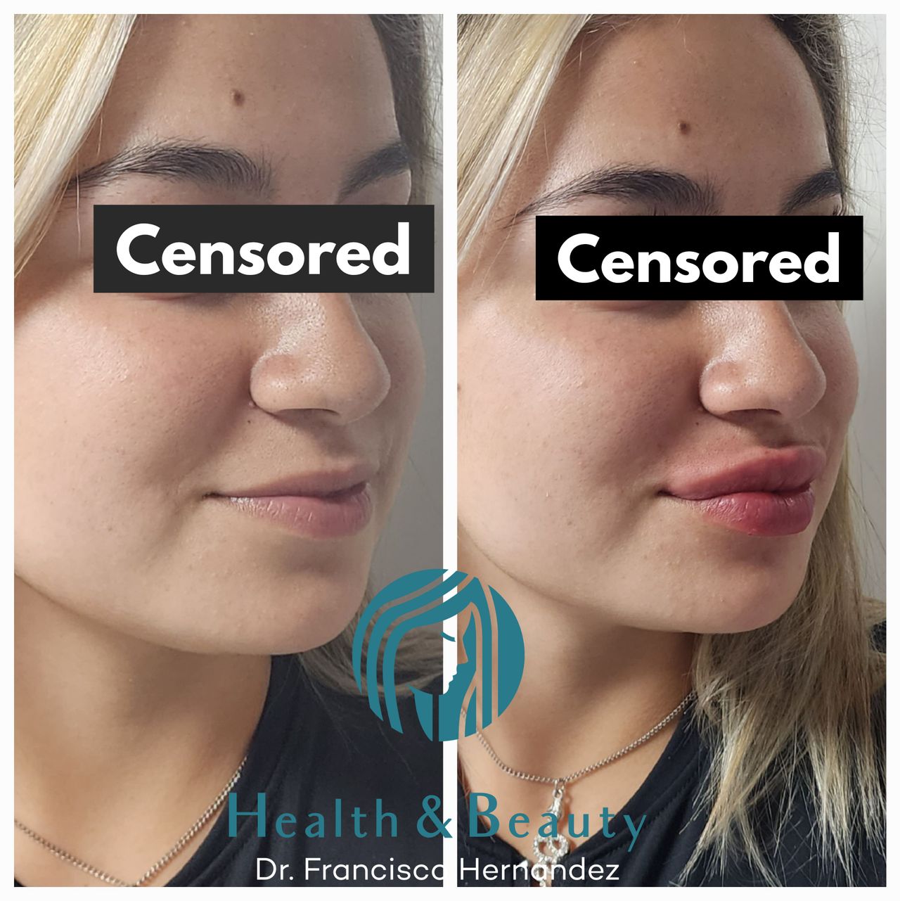 Francisco Hernández Gómez Crespo-45