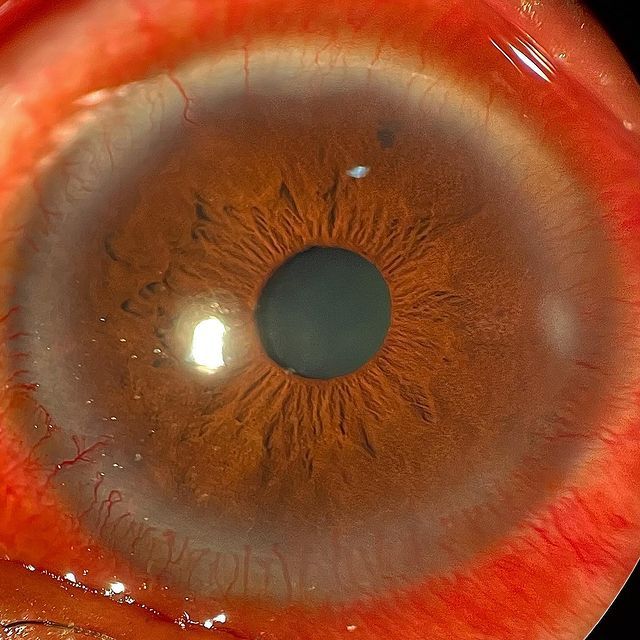 Nancy Edith Arreguín Rebollar-5