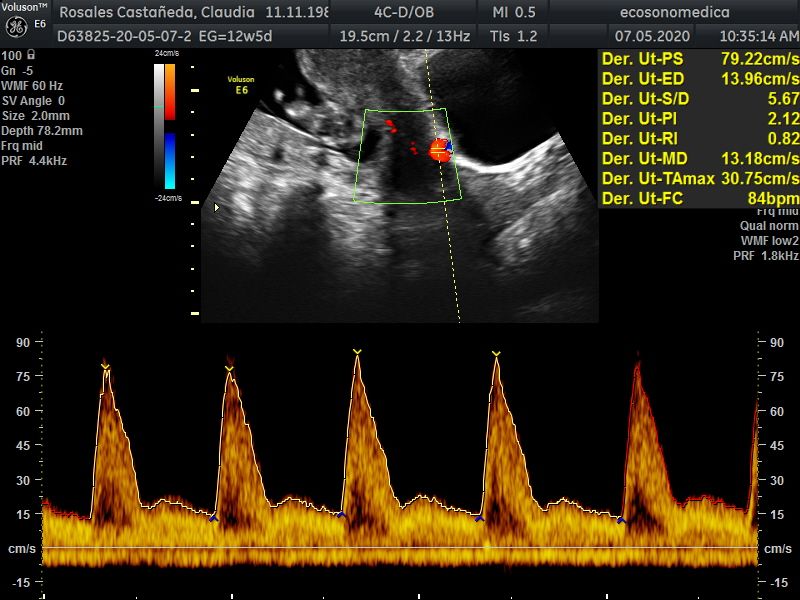 Héctor Bernardo Acevedo Manrique-15