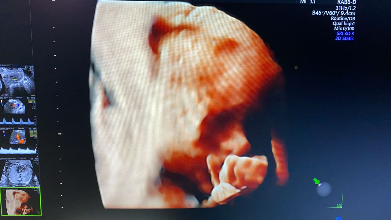 Merle Sánchez López-4