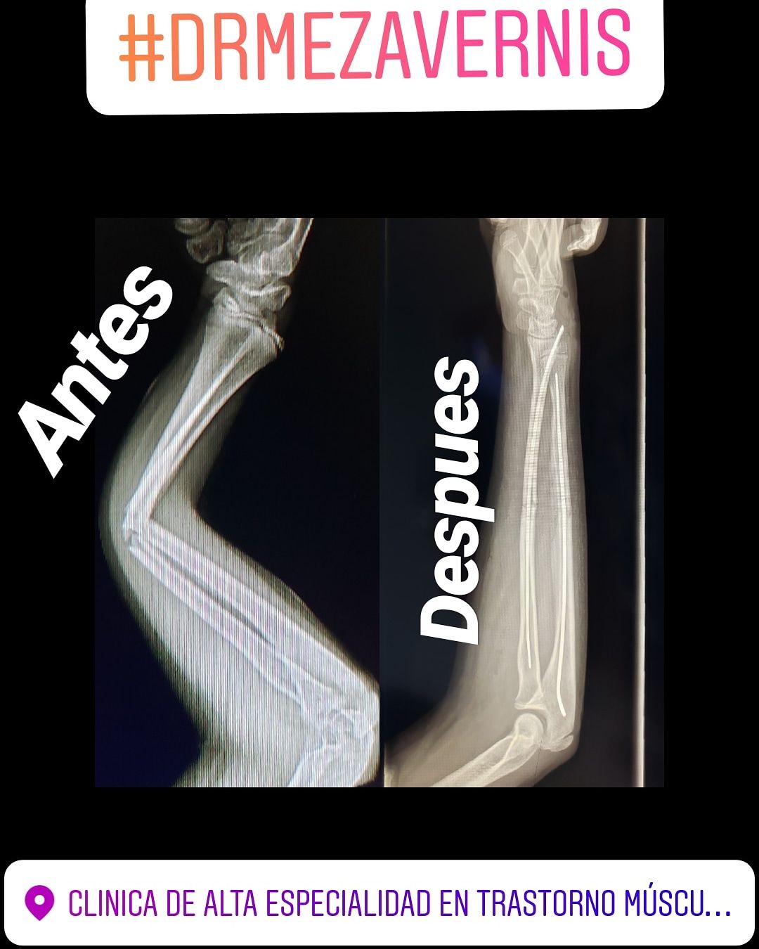 Alfonso Meza Vernis-85