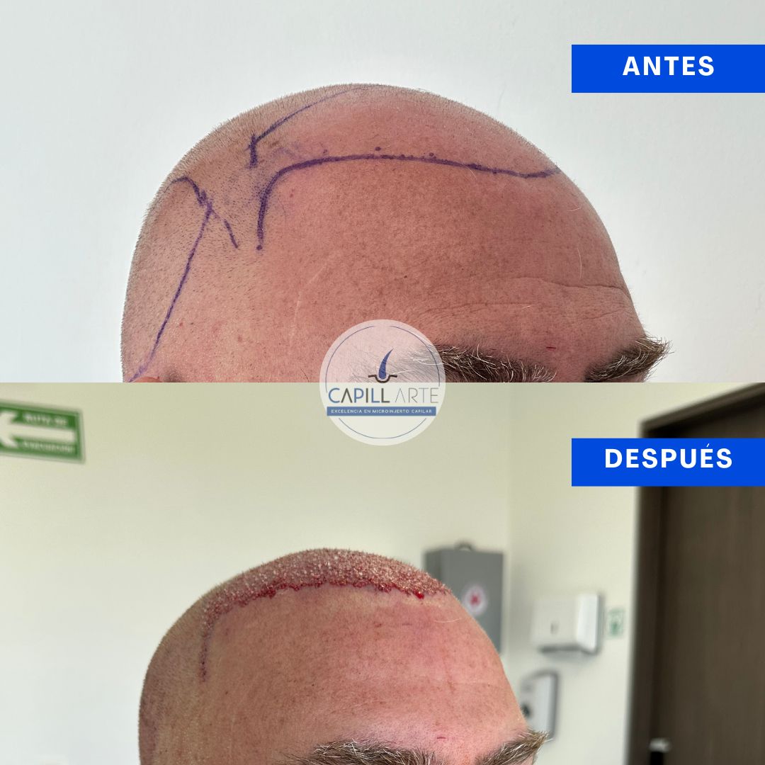 Adrian Hernandez Lopez-34