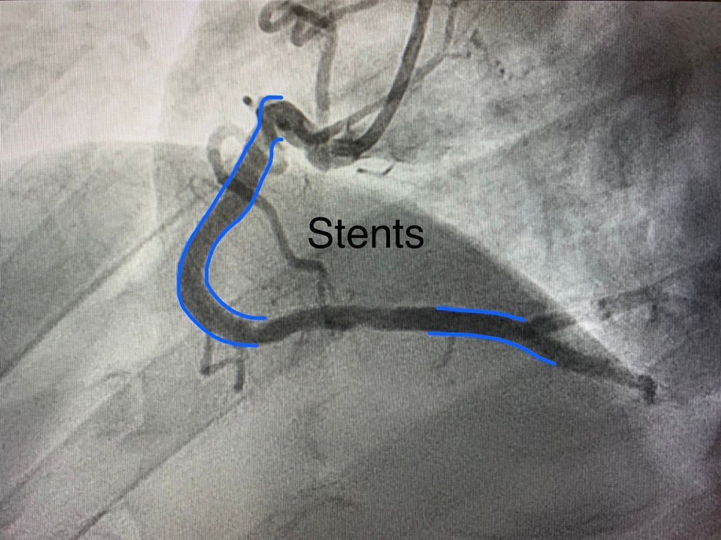 Juan René Cornejo Avendaño-15