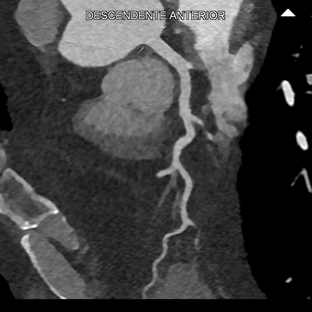 Miguel Franco Estrada-2