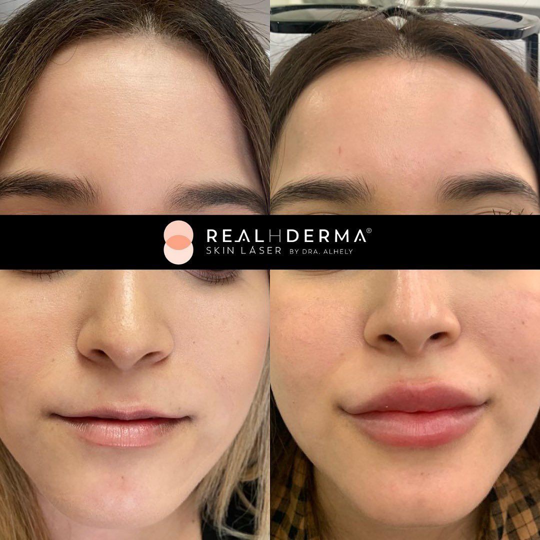 Laura Alheli Niebla Maldonado-6