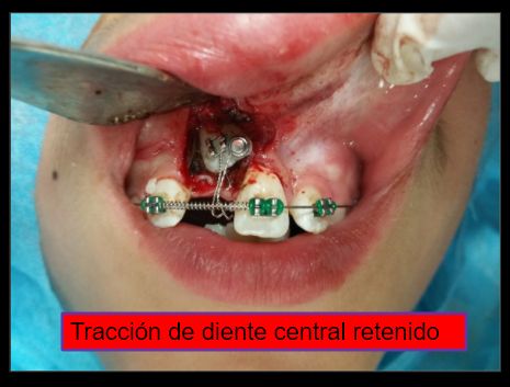 Diana Araceli Dávila Hernández-9