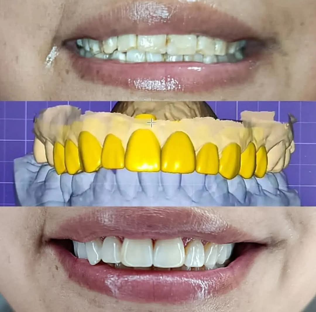 María Rossana Robles Sánchez-20