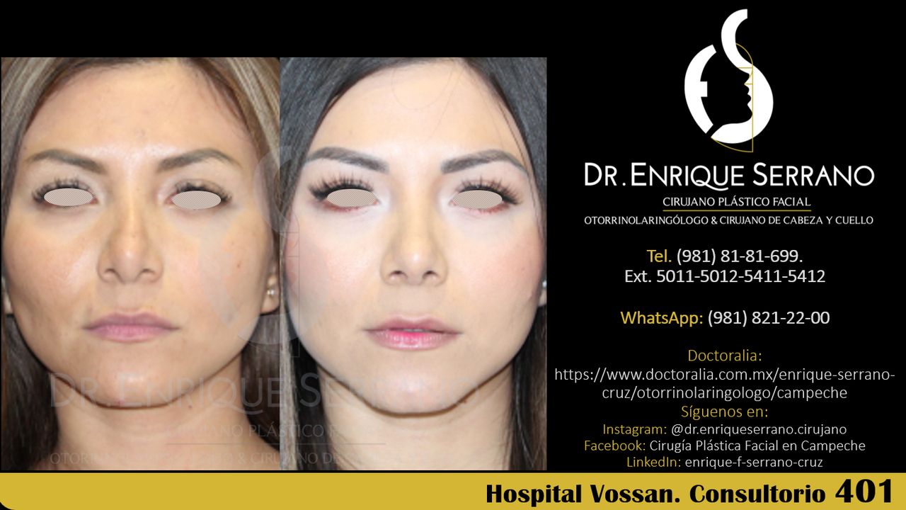 Enrique Serrano Cruz-86