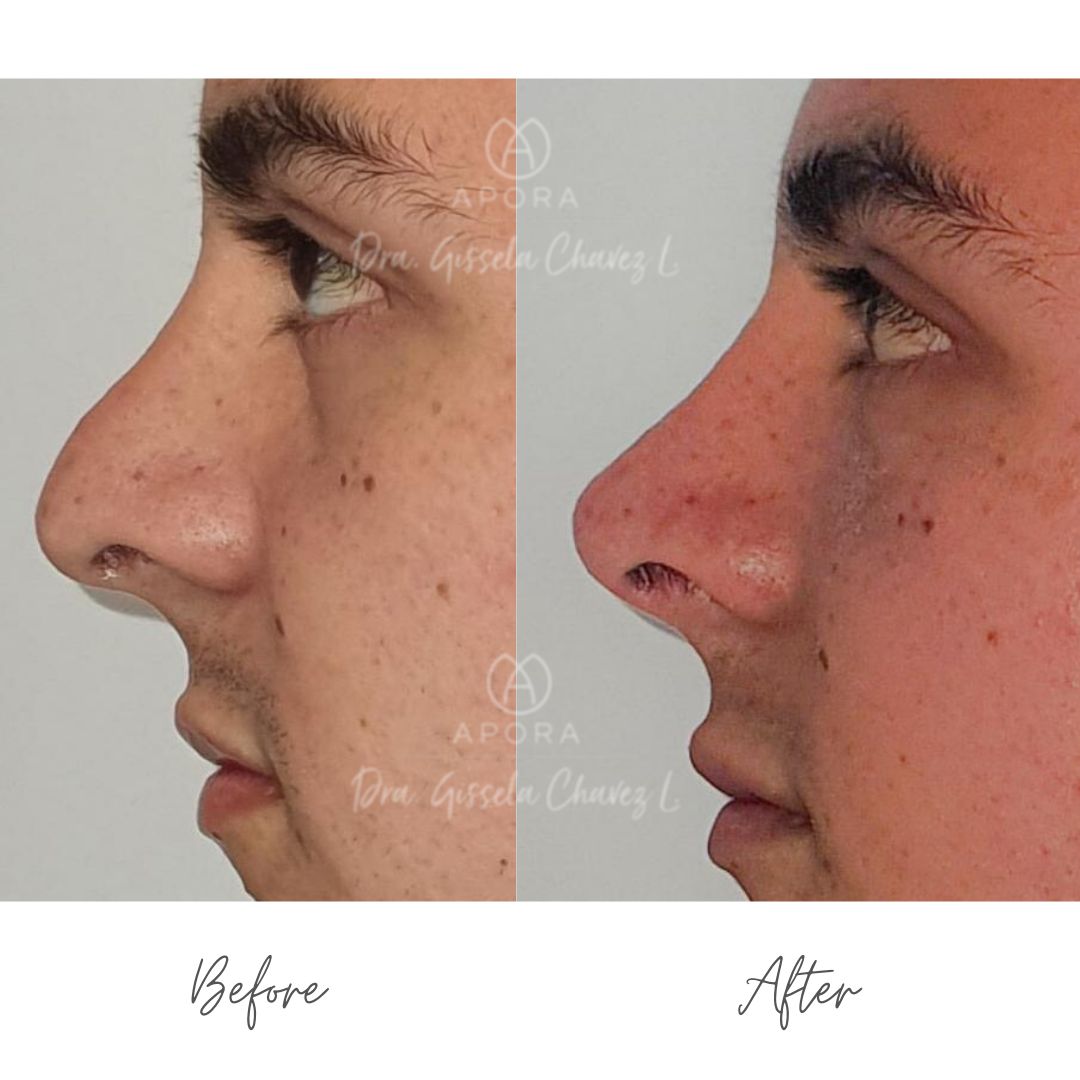 Gissela Chávez Lizardi-11