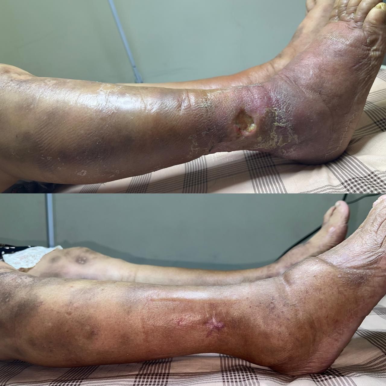 Jhonatan López González-36