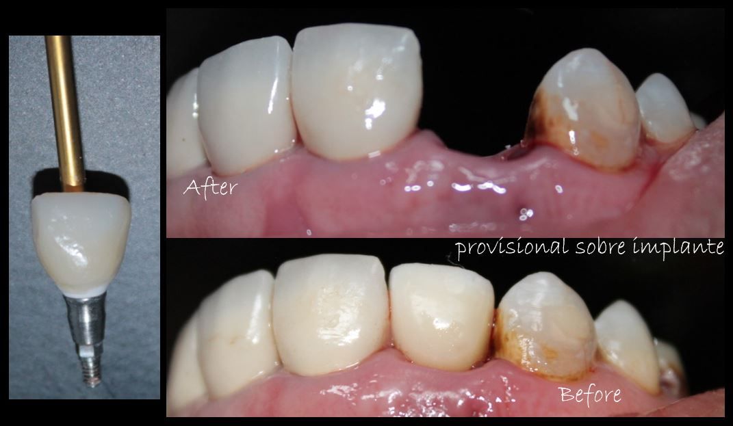 Aimee Valles Monárrez-25