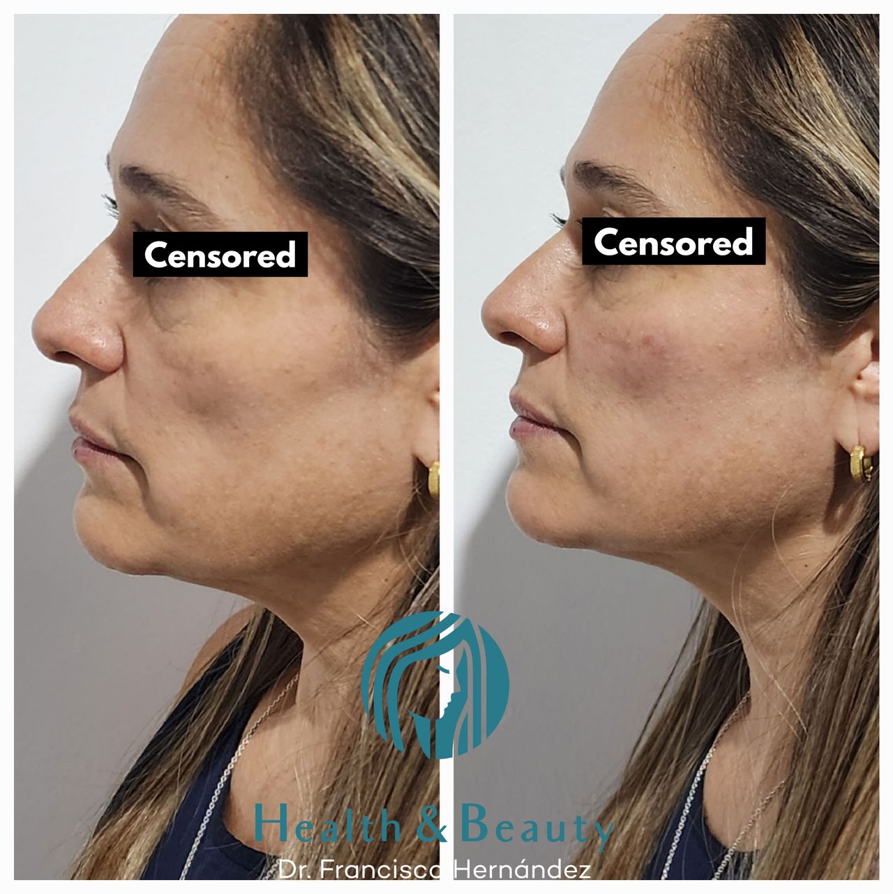 Francisco Hernández Gómez Crespo-10