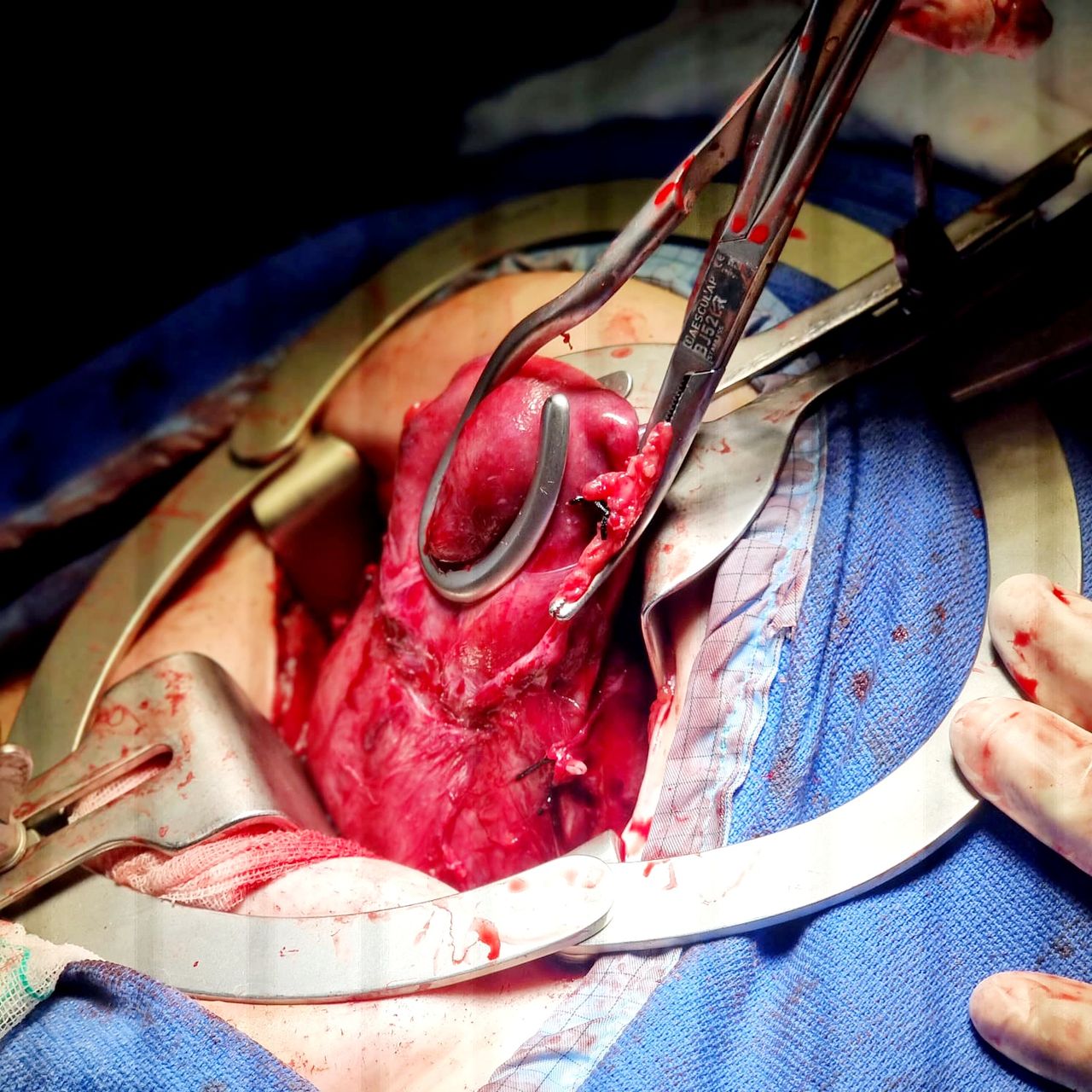 Martha Ivette Mejia Chavez-11