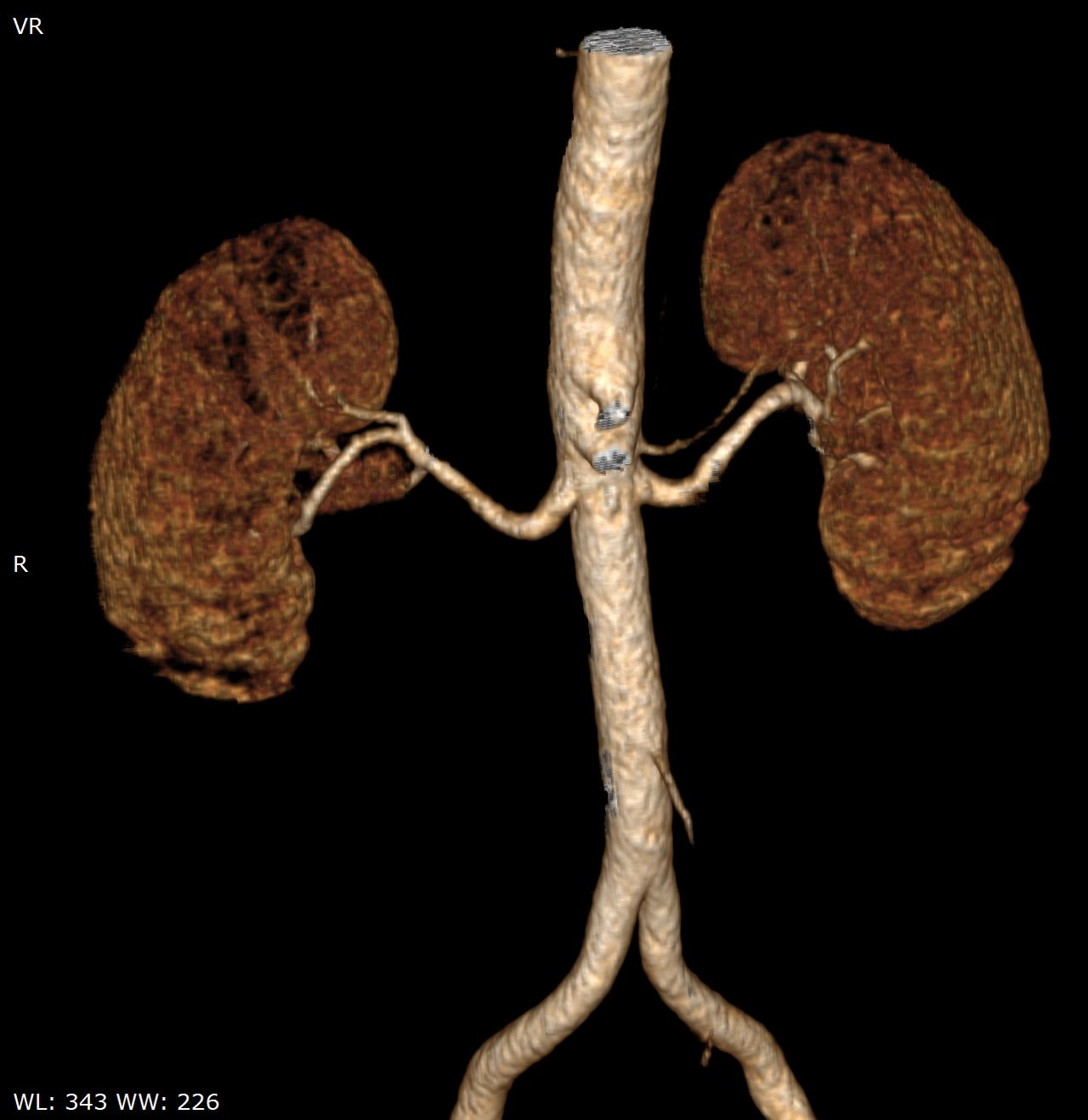 Nicolás Serrano Heredia-8