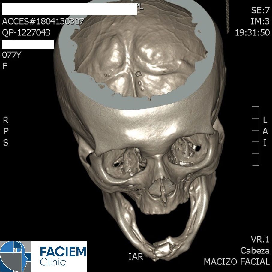Arlen Colín Ordaz-50