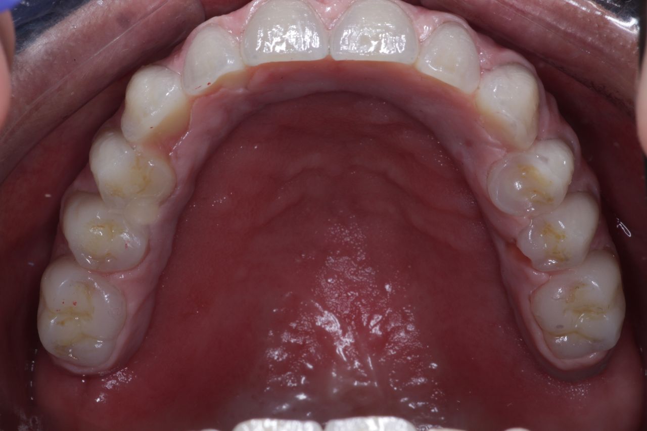 Josué Márquez Gómez-118