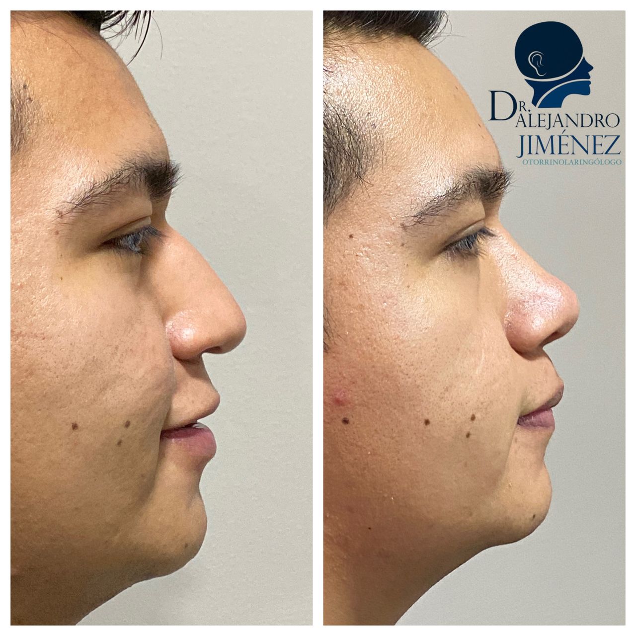 Alejandro Jimenez Garcia-31