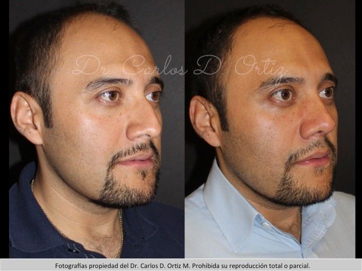 Carlos David Ortiz Moreno-38