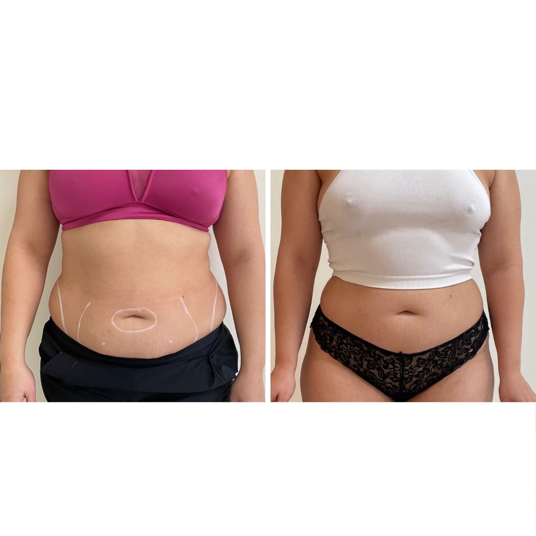 Alejandra Gutierrez García-31