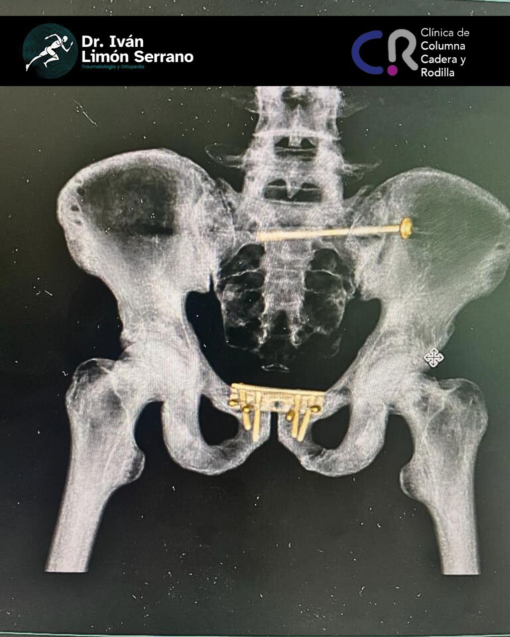 Iván Limón Serrano-22