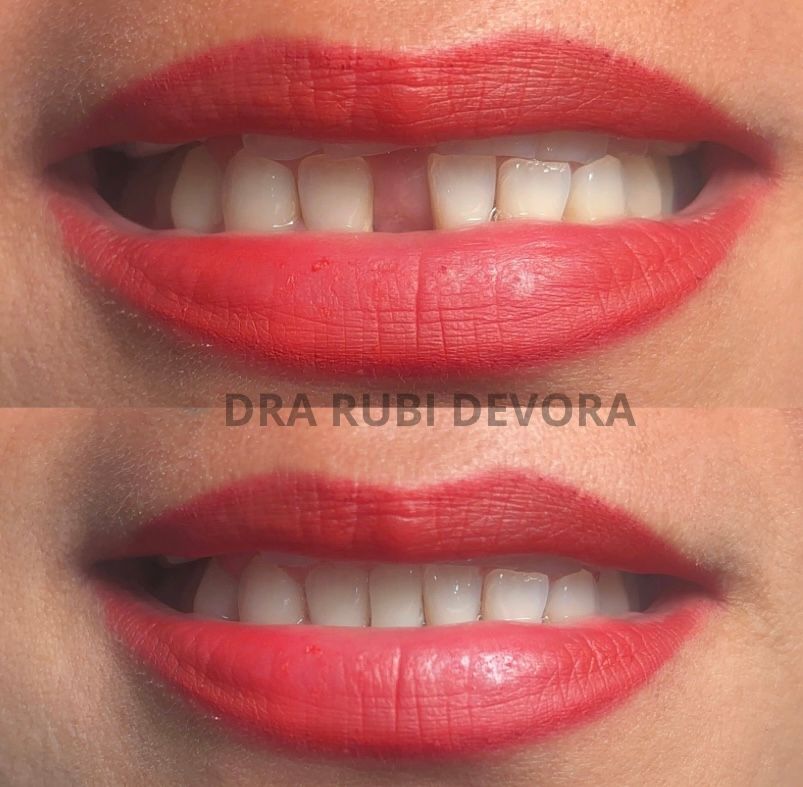 C Rubi Devora Figueroa-22