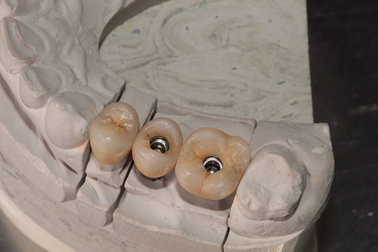 Aide Montserrat Orozco Gutierrez-33