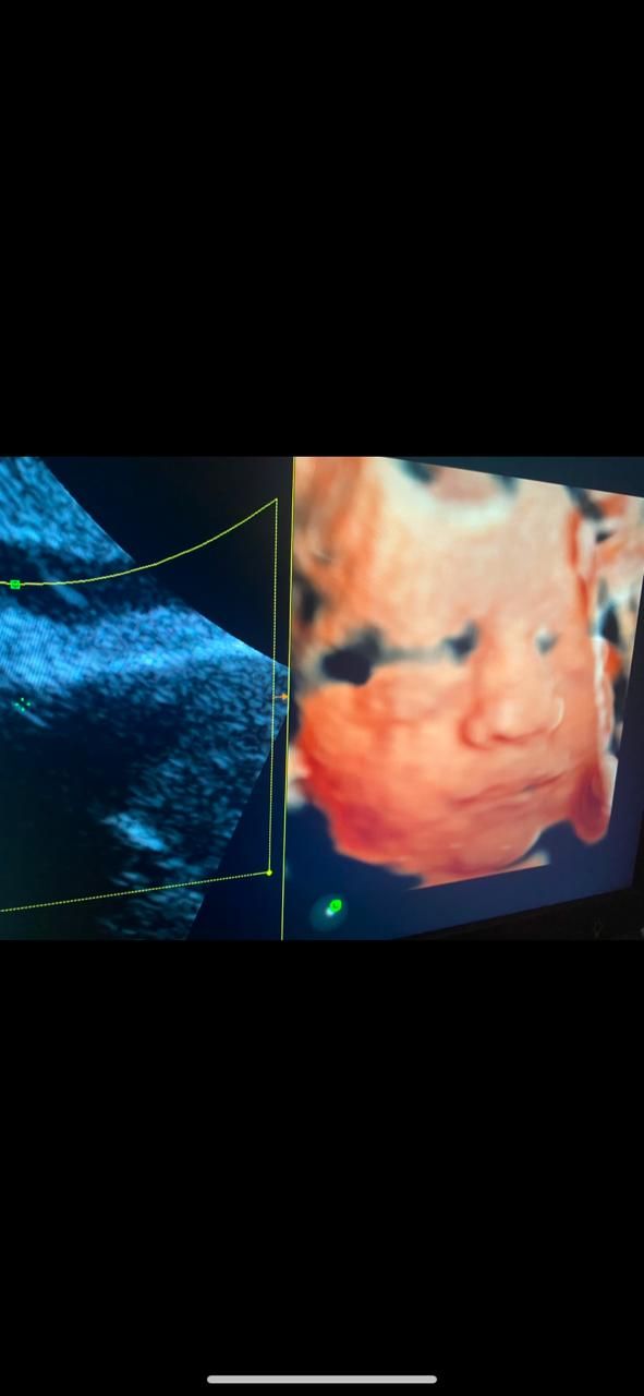 Graciela Elizabeth De La Torre Alvarez-10