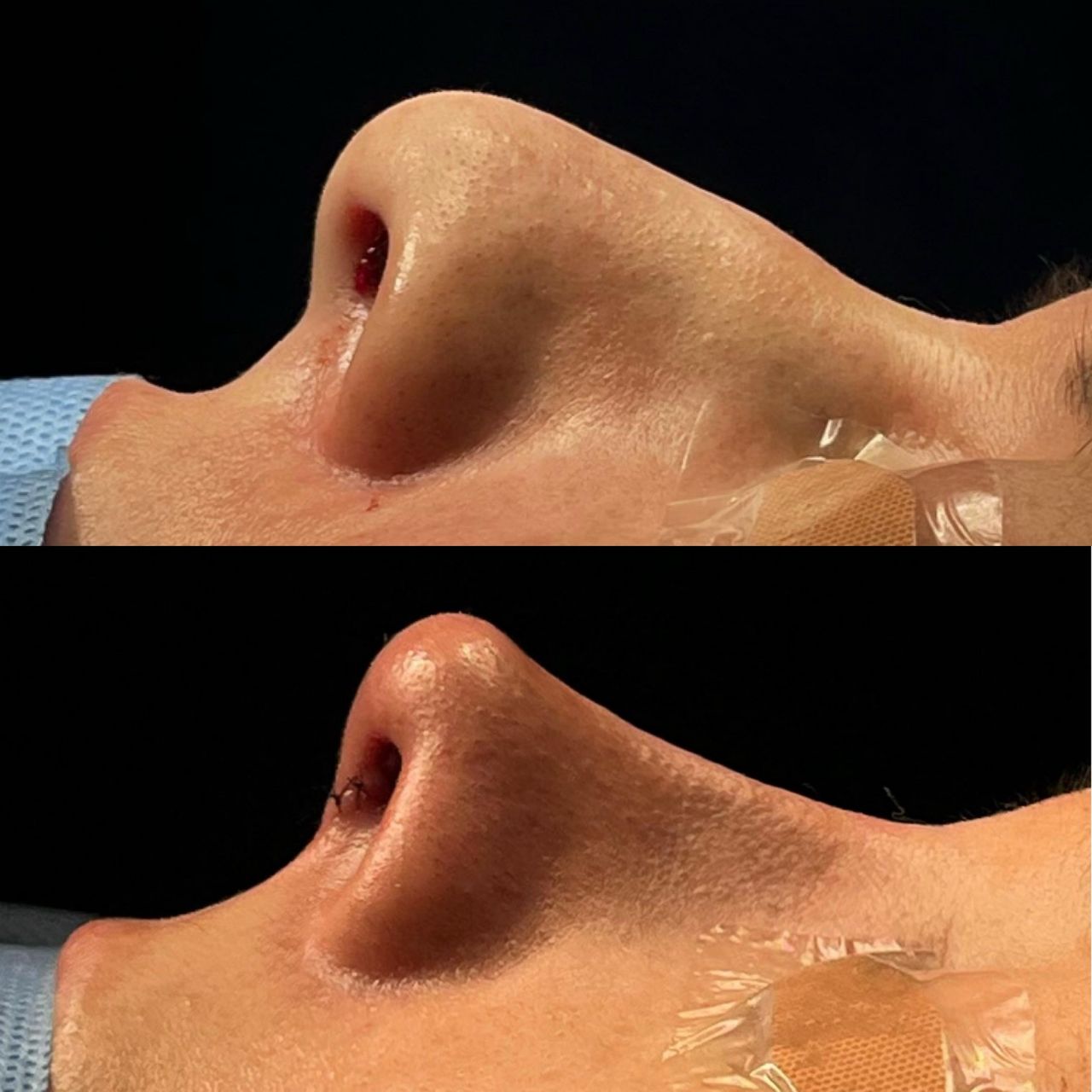 Giuseppe Tanzillo-69