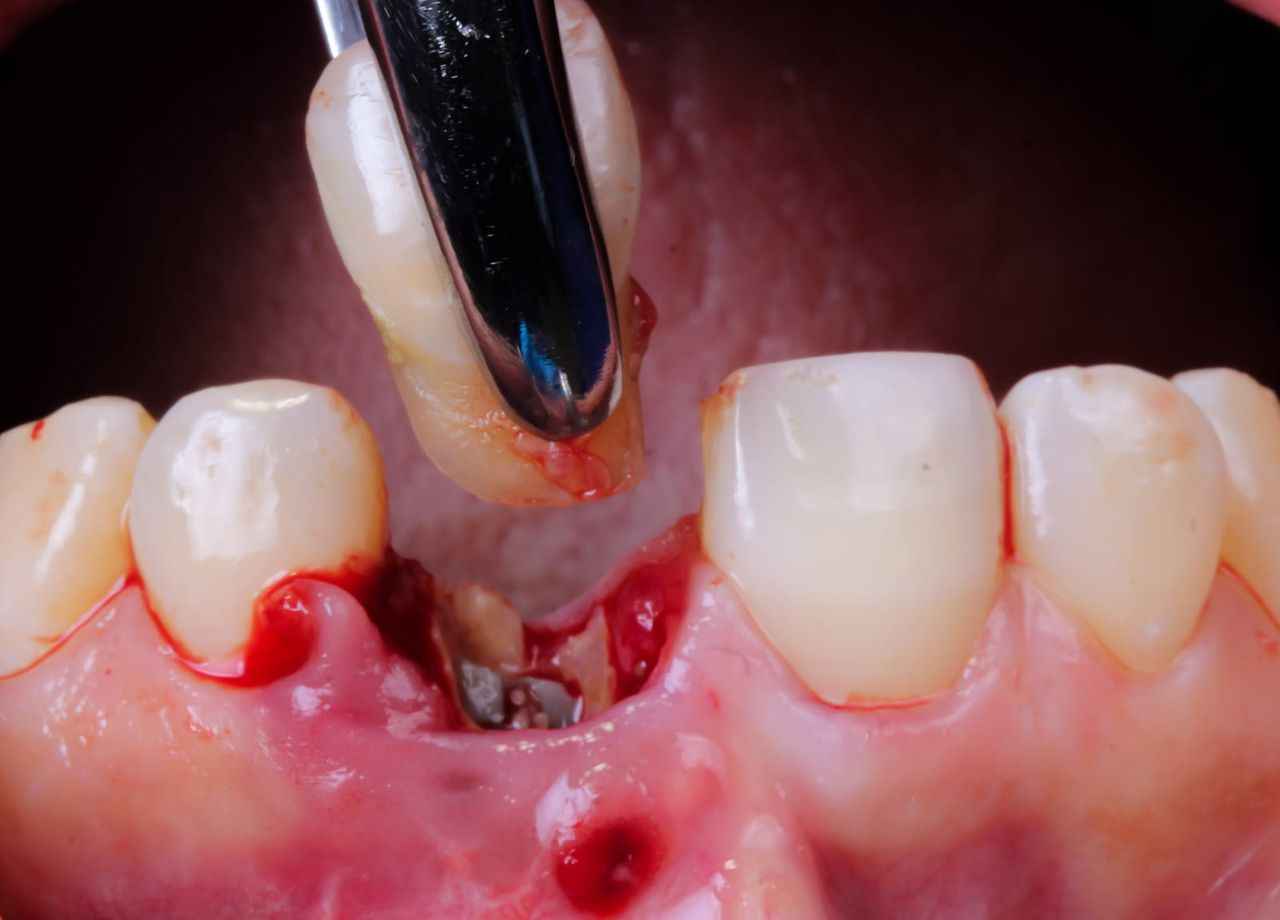 Hugo Enrique Aguilar Lamas-17