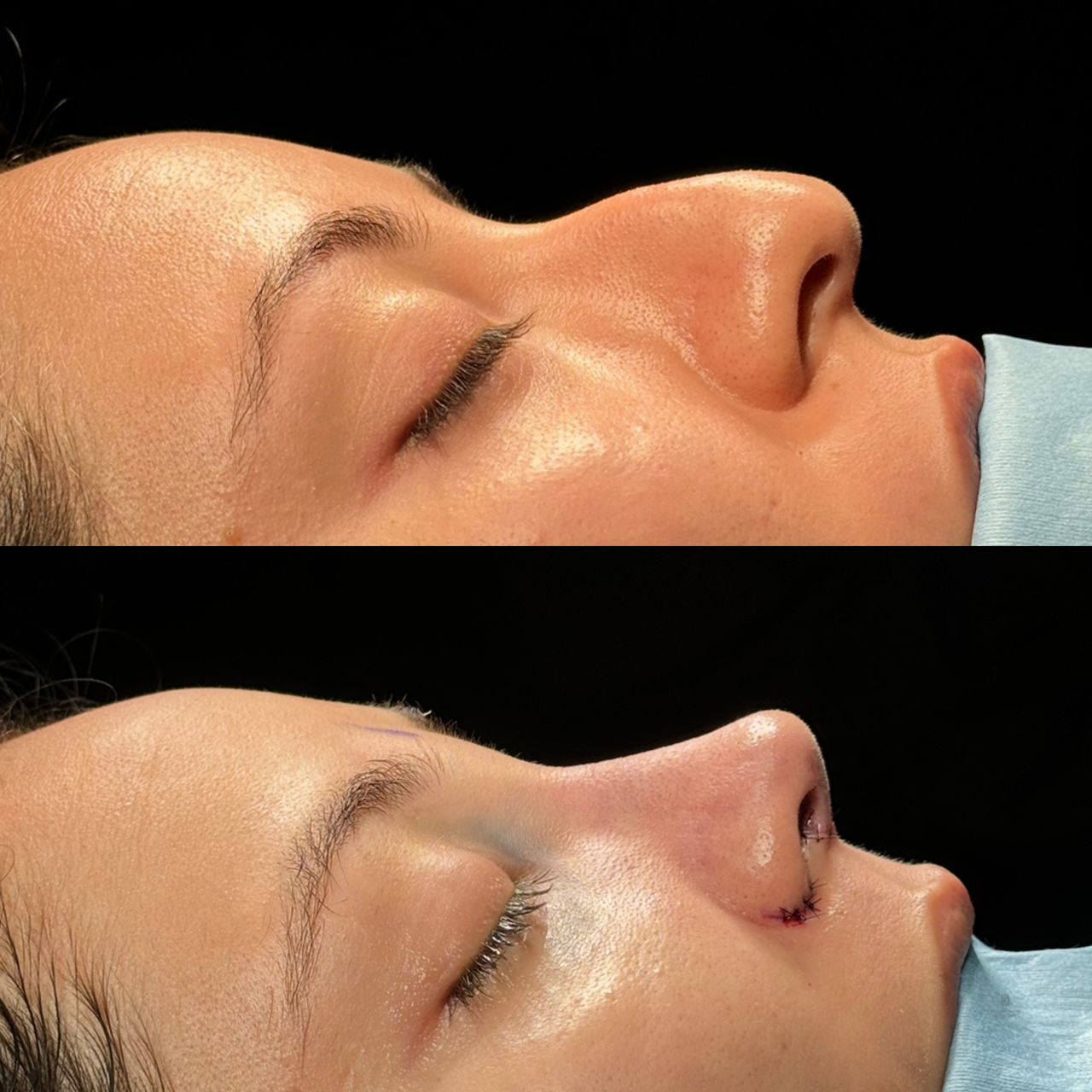 Angel Castro Urquizo-25