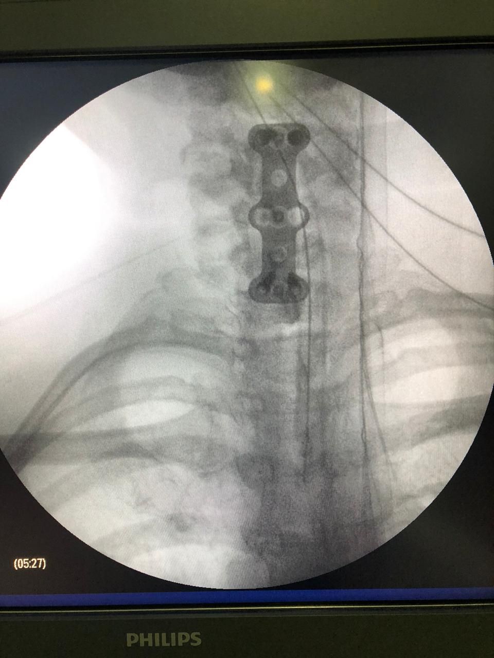 Juan José Luévano De La Cruz-17