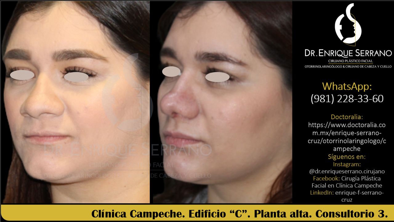 Enrique Serrano Cruz-74