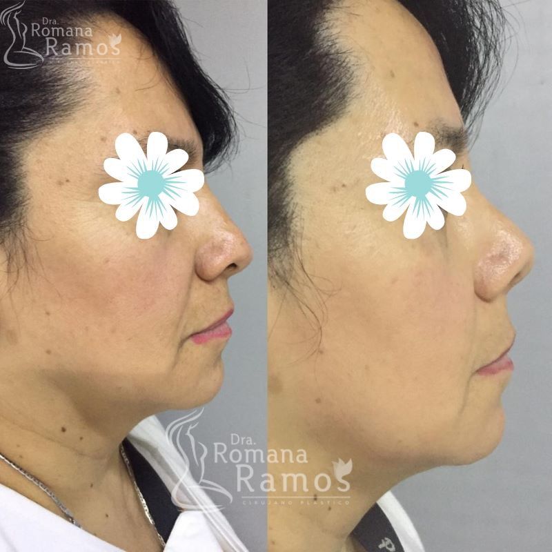 Romana Ramos Cárdenas-27