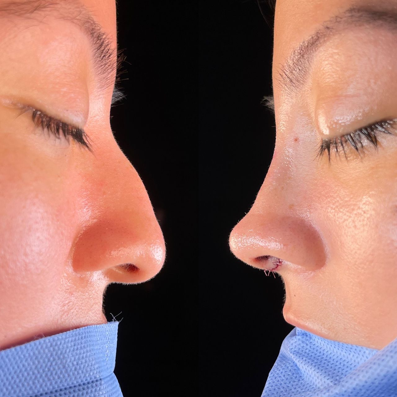 Angel Castro Urquizo-178