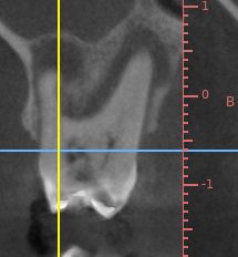 Alam Azael Arrazola González-22