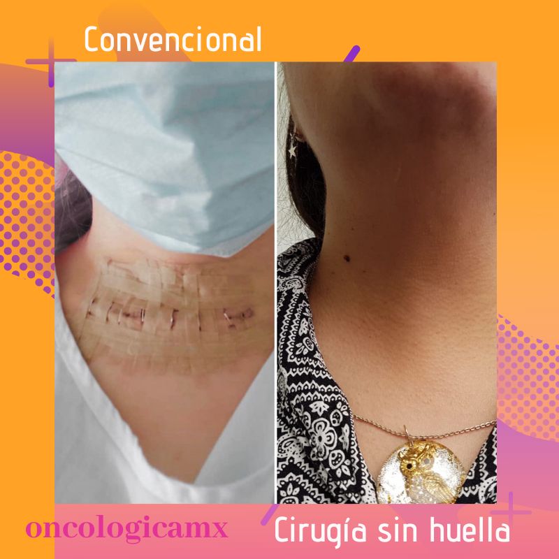 Manuel Acuña Tovar-0