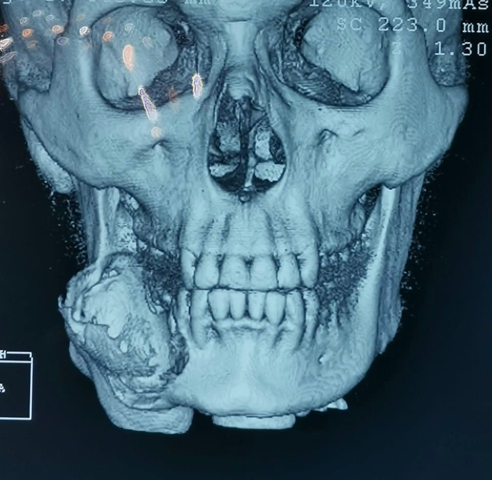 Luis Humberto Garcia Cabrera-9