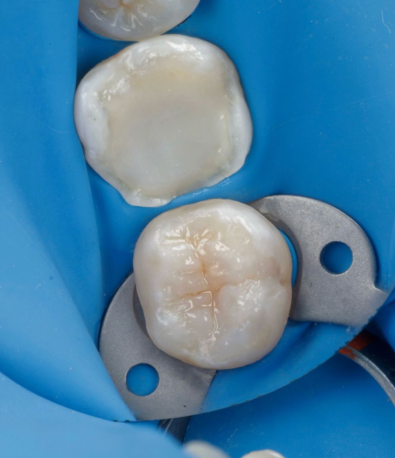 Fredy Alejandro Roblero Gónzalez-48