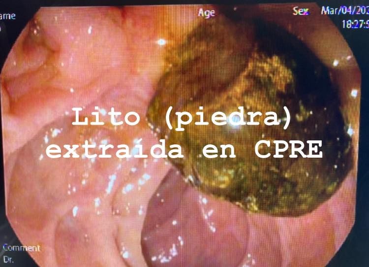 J. César Reyes Vásquez-15