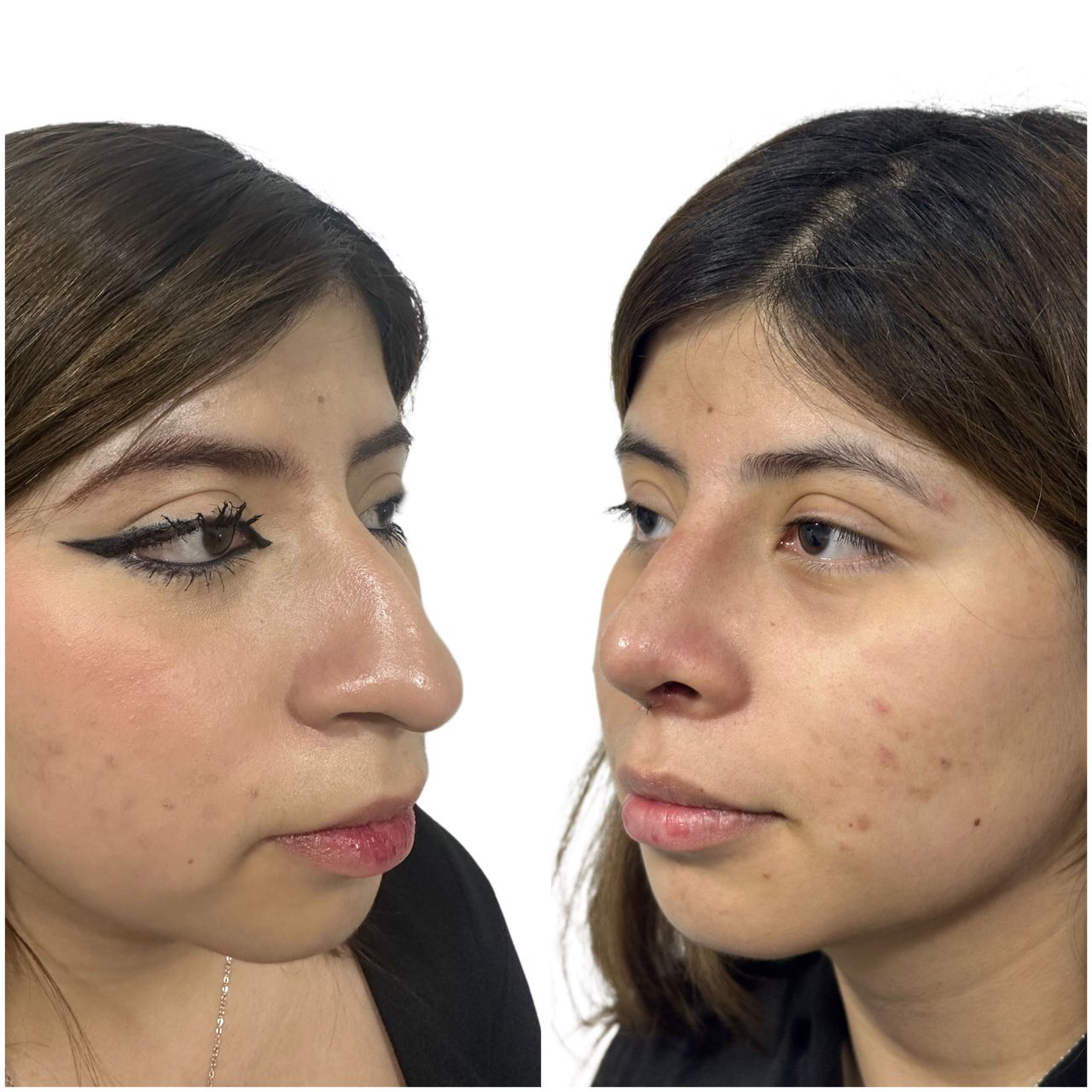 Abraham Hernández Mundo-11