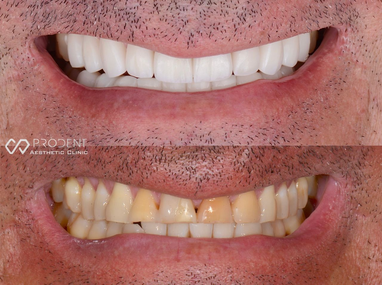 Ulises Pérez Murillo-58