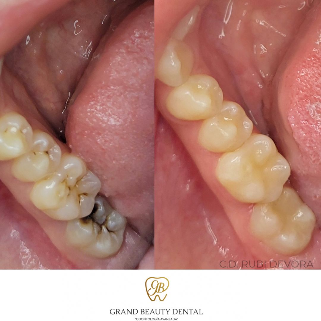 C Rubi Devora Figueroa-11