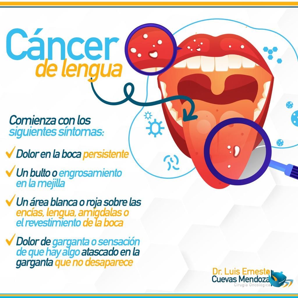 Luis Ernesto Cuevas Mendoza-142