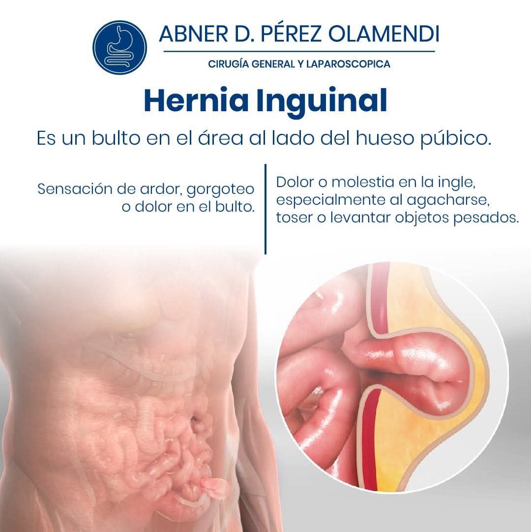 Abner Daniel Pérez Olamendi-3